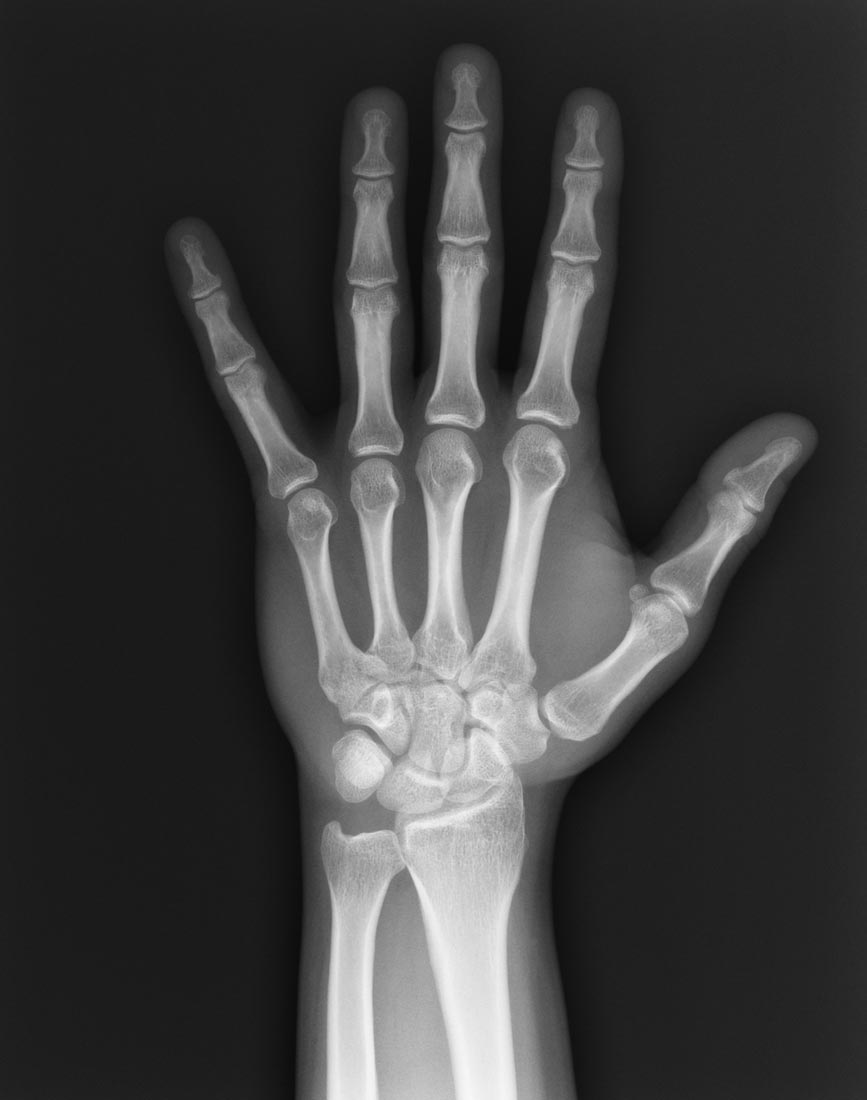 рентген руки